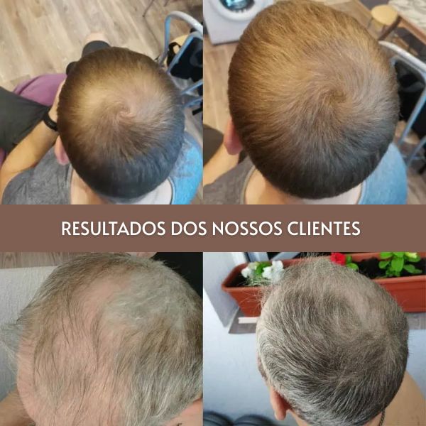 HairVelvet Power — Pó Capilar de Alta Cobertura a Prova D'água karavelas 